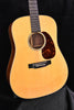 Used Custom Shop Martin "D-28 Style" Dreadnought - Adirondack Spruce and Madagascar Rosewood- Hide Glue Construction- 2015